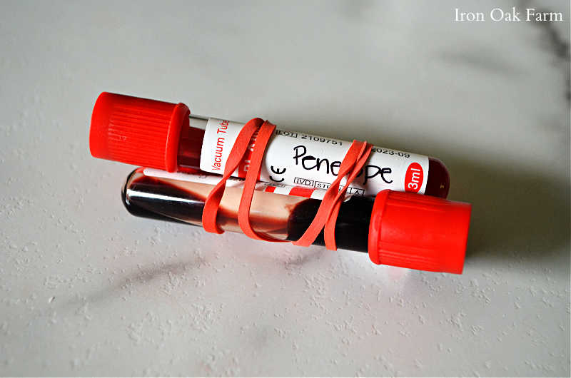 Blood vials in rubber band